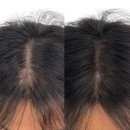 유진안전컨설팅 | 대전 두피문신 가격이 천차만별인 이유, 가격보다 먼저 확인해야 할 것들 ⭐️