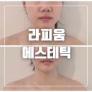 다사 동화아이위시 삼거리 | 다사피부관리 라피움에스테틱 윤곽관리 전후사진