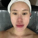 연수동피부관리 속건조에 좋은 리쥬벤관리 티나에스테틱 후기