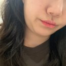 황금피부과의원 | [서초/선릉] 누브의원 이중턱 윤곽주사 피부과 내돈내산 시술 후기