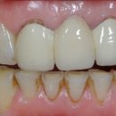 에나멜치과기공소 이미지