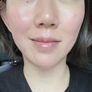 [강릉] 강릉피부샵추천 “썬바디 에스테틱” 플라모드케어로 이중턱관리했어요