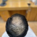 머리카락헤어샵 이미지