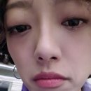 뷰티온의원 강서점 | 뷰티온의원 강서점 내돈내산_친구따라 마곡갔던 보라...점빼기&amp;미용시술 결제까지 하고 온 후기ㅋ_ㅋ