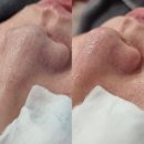 오늘더예쁘다 | 수유 피지관리 블랙헤드 뿌리 뽑는 법 가오리역 피부관리 오늘도예쁘다 진단 후기