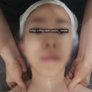 미소페이스 | 강남피부관리 라티엔에서 페이스관리 받은 후기