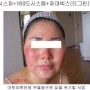 건강을 드립니다.아토피로 고민하세요? 이미지