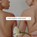 스킨엔젤라