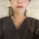 린토탈뷰티 | 신사역 피부관리 삐땅기린뷰티 LDM + 리페어팩 관리 후기