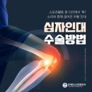 조승배의원 | 분당무릎병원 십자인대 이중재건술, 최신 치료 수술 트렌드