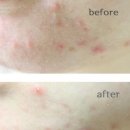 동안 피부 솔루션 이미지