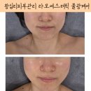 왕십리피부관리 추천 홍조 건조 피부를 투명하게 살려주는 산소수분 물광케어 후기