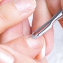 세방치과의원 | 내나이 24세 사랑니 처음으로 발치하다