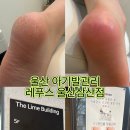 GS25 울산삼산점 | 울산 발각질관리 울산 아기발관리 레푸스 울산삼산점 후기