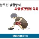 인공관절수술!! 수술 후 관리가 더 중요 이미지