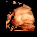 미스 미즈 산부인과의원 | 제천 연세미즈 산부인과 출산후기 제왕절개 그리고 출산준비를 곁들인...