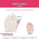 현가한의원 Daum카페