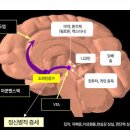 [이상심리 9강] 조현병 스펙트럼 장애-조현병,조현정동장애,단기정신병적 장애,망상장애, 이미지