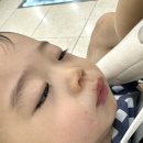 아이웰어린이병원 | 수ㅈ구라고 ...수족구!! 청주 아이웰입원기