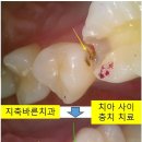 한치과기공소 이미지