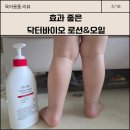 앤바이오 | 태열에좋은로션추천 닥터바이오로션앤오일 아기땀띠 관리 후기