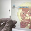 딤플