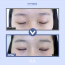 아우어성형외과의원 이미지
