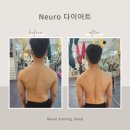 뉴로트레이닝센터 이미지