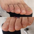 레푸스송탄점 네이버블로그
