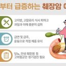 췌장을 살리는 기술(技術) 이미지