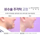 뉴욕본치과의원 네이버블로그