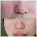 자연미인 에스테틱 | 구의동 피부관리 자연미인 에스테틱에서의 맞춤형 수기 관리 후기