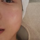 황미서에스테틱트리플에이 | 한남동에스테틱 메이브에스테틱 한남본점 | 물광피부 후기✨