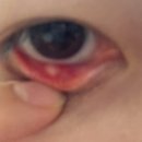 대연본안과의원 이미지