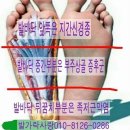 지간신경종이란-지간신경종 쉽게 해결하는법 이미지