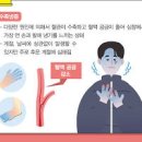 수족냉증 원인 관리 이미지