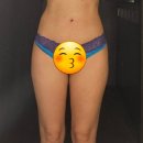 허리웃 | 구월동비만클리닉 복부지방흡입과 힙업수술 3주차 후기 (+고주파관리)