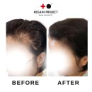 리게인프로젝트 일산 | 정발산동두피문신 후기가 증명하는 샵, 일산 리게인프로젝트