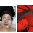 3352 | 두정동피부샵 찾는다면? 천안두정 비엘뷰티 에스테틱 관리후기