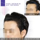 모앤라인성형외과의원 네이버블로그