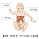 중쇄 아실코에이 탈수소효소 결핍증[Medium-Chain Acyl-Coenzyme A Dehydrogenase Deficiency](M 이미지