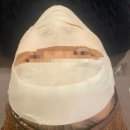과천 지정타 피부과에서 재생레이저로 홍조치료 받고왔어요