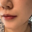 봄눈피우다의원
