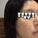 오편한 한의원 | 금호동 경희최우수한의원 스킨 부스터 2회차 후기