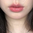 다팔아 | 홍대피부과 입술필러 발품팔아 다녀온 후기