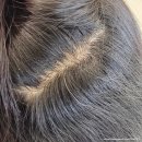 썸헤어 | 안산헤어썸 아베다 두피클리닉 후기! 환절기 두피관리 필수