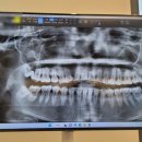 예스서울치과의원 이미지