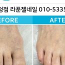 푸스케어 파주운정점(라푼젤네일)