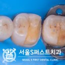 퍼스트 치과기공소 이미지