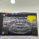 턱편한사랑니치과의원 | [🥹] 네 뺐습니다. 사랑니 ! 금요일 (범계역 턱편한사랑니치과 후기/비용)